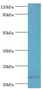 Polyclonal Rabbit anti-Human SOCS2 Antibody (aa1-198, IHC, WB)