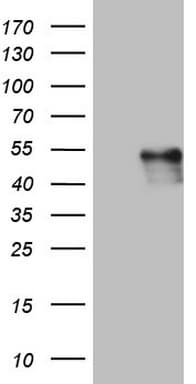 POMK / SGK196 Antibody (aa141-350, clone OTI4D9)