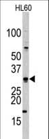 CDCA8 / Borealin Antibody (aa115-144)