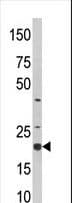 SKP1 Antibody (aa58-87)