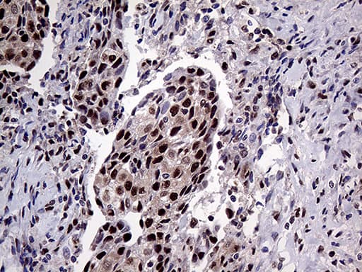 PPP4C Antibody (clone OTI2E4)