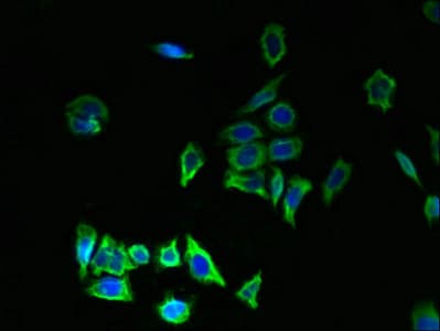 Polyclonal Rabbit anti-Human TMEM176B / LR8 Antibody (IHC, WB)