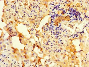 RBM12 Antibody