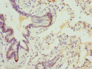 Polyclonal Rabbit anti-Human ABCA3 Antibody (aa43-203, IHC)