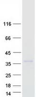 Human C25H / CH25H Protein (Recombinant Myc-DDK (Flag))