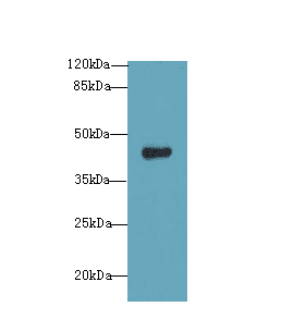 IHC-plus™ Polyclonal Rabbit anti-Human RNF128 / GRAIL Antibody (IHC, WB)