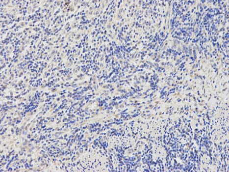 BTC / Betacellulin Antibody