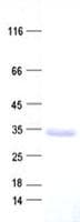 Human FBXO25 Protein (Recombinant His, N-Terminal)