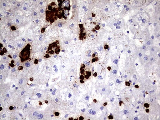 S100A9 / MRP14 Antibody (clone UMAB173)