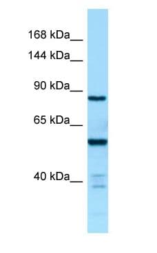 CTDP1 / FCP1 Antibody (aa521-570)