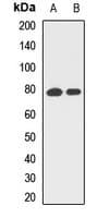 Polyclonal Rabbit anti-Human RANBPM Antibody (WB)
