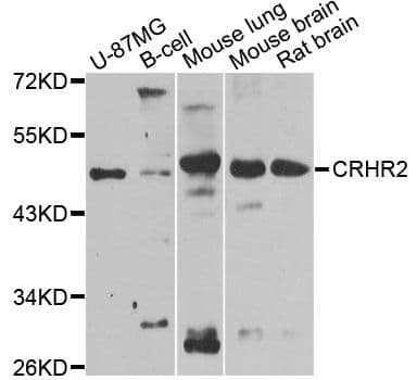 CRHR2 / CRF2 Receptor Antibody