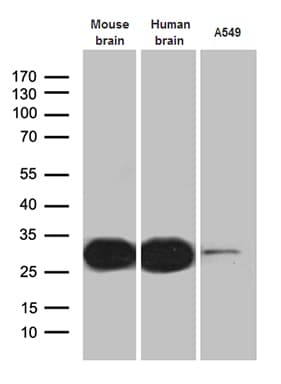 CALB2 / Calretinin Antibody (clone OTI1A1)