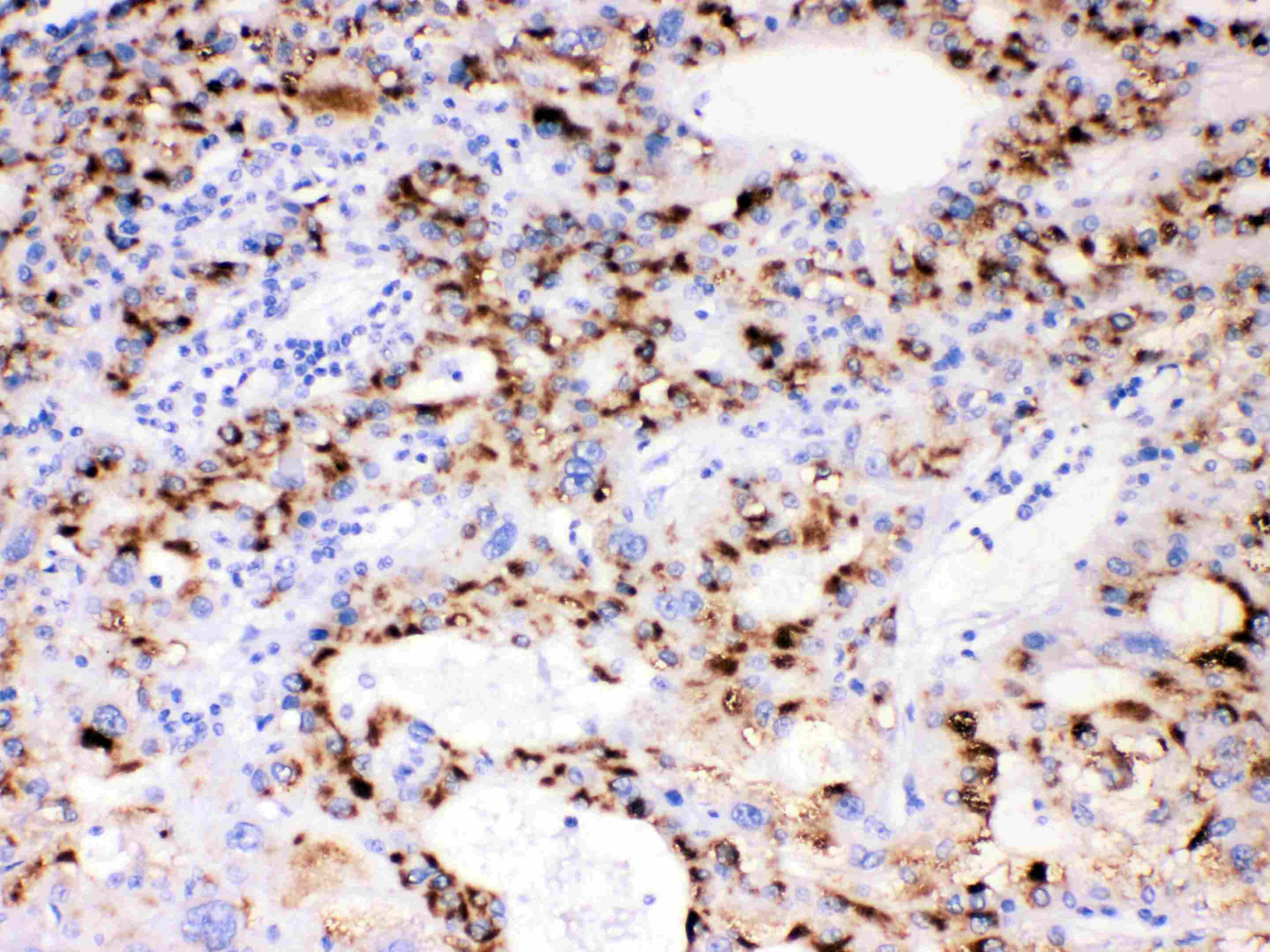 CYP3A4 / Cytochrome P450 3A4 Antibody