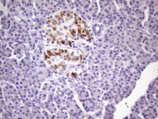 Zfp105 / ZNF35 Antibody (aa1-258, clone OTI3B5, Carrier-free)