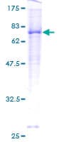 Human ACVRL1 Protein (Recombinant GST)