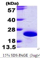 Human NCS1 / Neuronal Calcium Sensor Protein (Recombinant His)