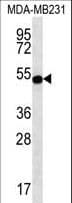 Polyclonal Rabbit anti-Human STAP2 Antibody (aa187-216, IHC, WB)