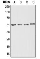 PathPlus™ RTN4R Antibody (Internal)