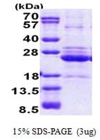 Human HLA-DOA Protein (Recombinant His)