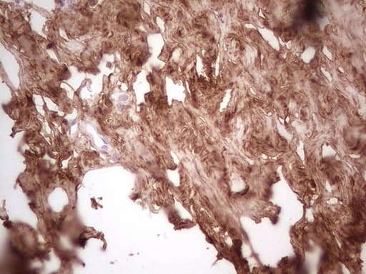 CSNK1G1 / CKI-Gamma 1 Antibody (aa163-422, clone OTI4D9)