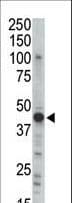 Polyclonal Rabbit anti-Human PRKAR2B Antibody (aa32-62, WB)