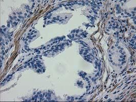 ERBB2 / HER2 Antibody (aa676-1255, clone OTI1D9, Carrier-free)