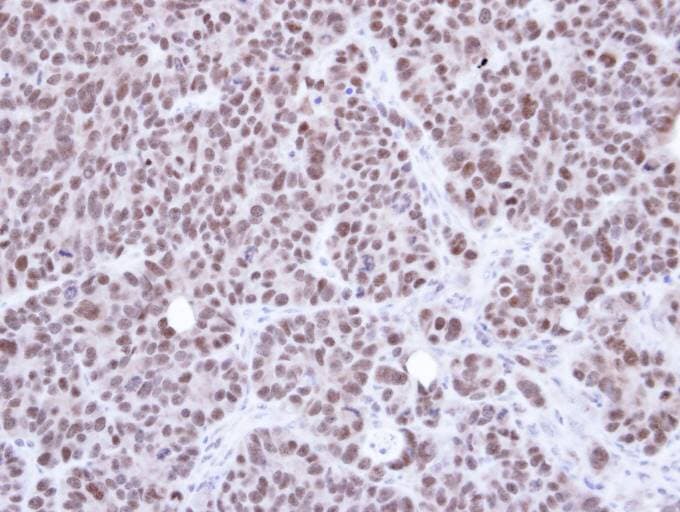 Polyclonal Rabbit anti-Human NSMCE1 Antibody (aa1-266, IHC, WB)