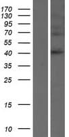 SERPINB8 Protein (Over-Expression Lysate Myc-DDK (Flag))