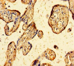 ZBED1 / TRAMP Antibody