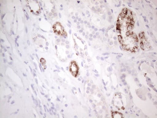 AMACR / P504S Antibody (clone OTI3E10)