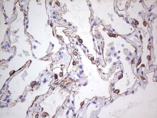 Monoclonal Mouse anti-Human KRT19 / CK19 / Cytokeratin 19 Antibody (clone OTI5F4, aa240-390, IHC, WB)