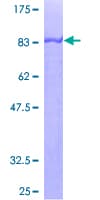 Human CRNN / Cornulin Protein (Recombinant GST)