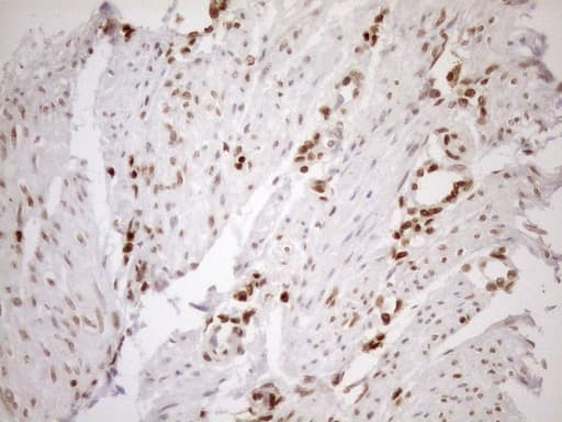 MGMT Antibody (clone OTI2E2)