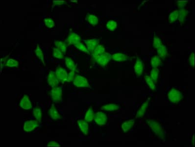 Polyclonal Rabbit anti-Human SHPRH Antibody (IHC, IF)