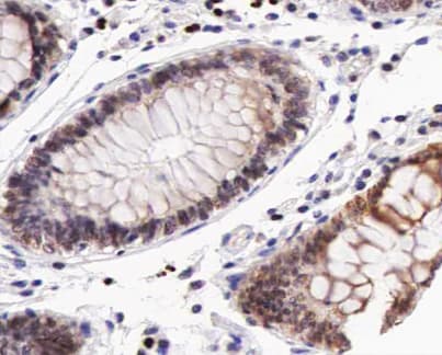 Polyclonal Rabbit anti-Human EMA / MUC1 Antibody (phospho-Tyr1229, IHC, IF, WB)