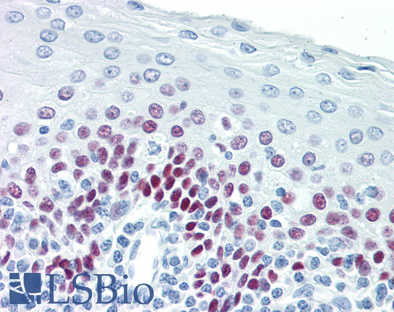 PathPlus™ Monoclonal Mouse anti-Human TP63 / p63 Antibody (IHC, WB)