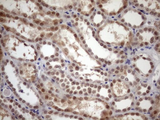 TDG / Thymine DNA Glycosylase Antibody (aa160-253, clone OTI3A12)