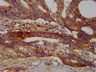 Polyclonal Rabbit anti-Human SBDS Antibody (IHC, IF)