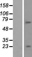 BTBD11 Protein (Over-Expression Lysate Myc-DDK (Flag))