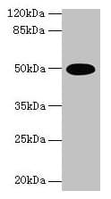 IHC-plus™ Polyclonal Rabbit anti-Human EFTU / TUFM Antibody (IHC, WB)
