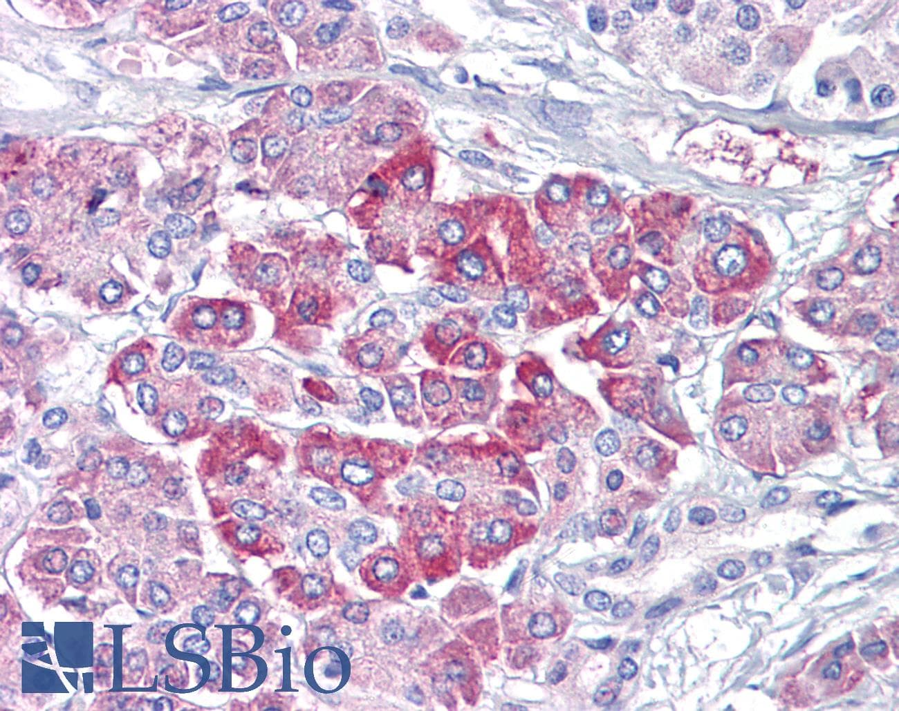 IHC-plus™ Monoclonal Mouse anti-Human NRAS / N-ras Antibody (clone AT2G9, IHC, WB)