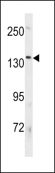 ATP8B3 Antibody (aa56-84)