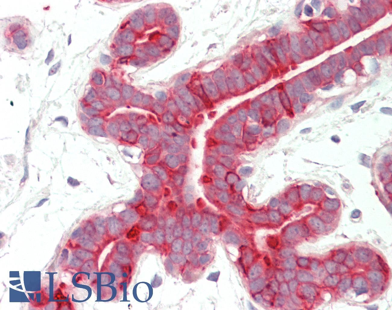 PathPlus™ KRT18 / CK18 / Cytokeratin 18 Antibody (aa200-300)