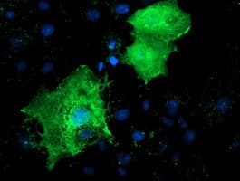 Monoclonal Mouse anti-Human LMCD1 Antibody (clone OTI1H5, IHC, IF, WB)