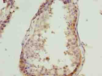 CSAG1 Antibody