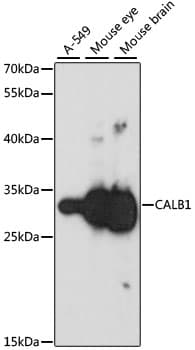 CALB1 / Calbindin Antibody