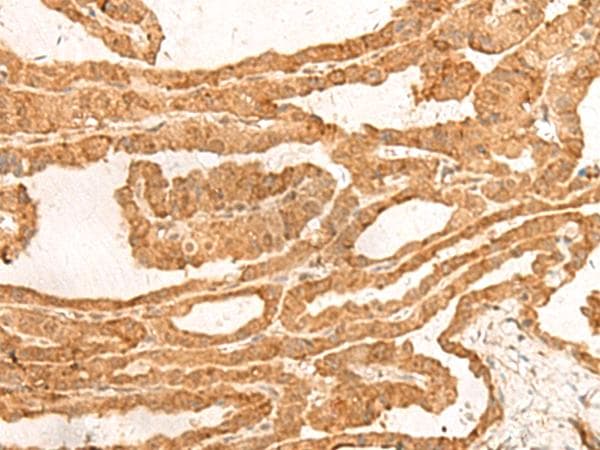 zinc finger and BTB domain containing 8 Antibody