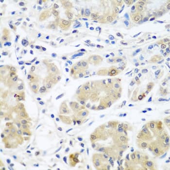 Polyclonal Rabbit anti-Human EIF3A Antibody (IHC, IF, WB)