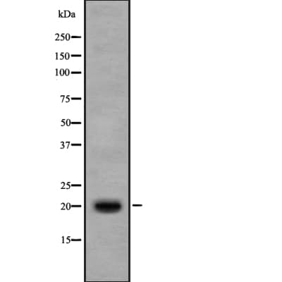IL17B Antibody